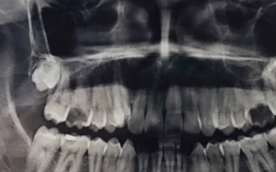 Sabes lo que los dientes dicen POR ti?